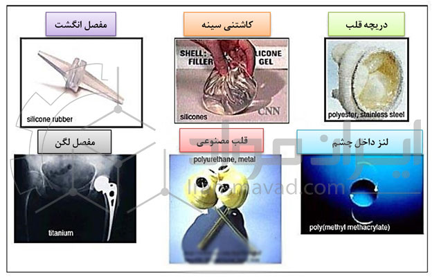 بعضی از تجهیزات پزشکی معمول که شامل بیو مواد می شوند